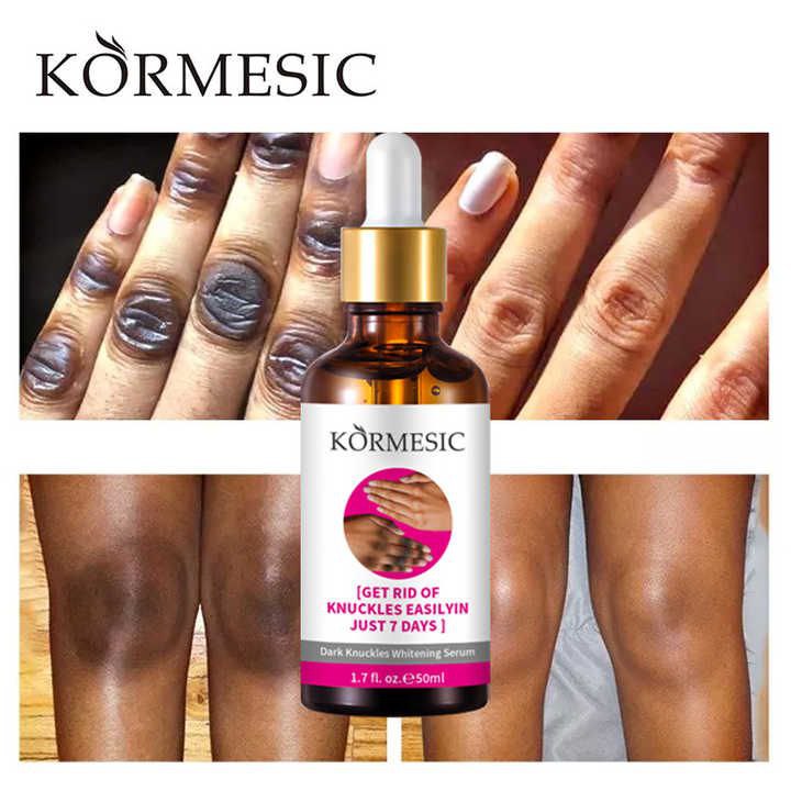 Kormesic ultra nettoyant de tache